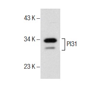 PI31 (26): sc-136416. Western blot analysis of PI31 expression in Jurkat whole cell lysate.