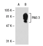 PIAS 3 (C-12): sc-46682. Western blot analysis of PIAS 3 expression in non-transfected: sc-117752 (A) and human PIAS 3 transfected: sc-114958 (B) 293T whole cell lysates.