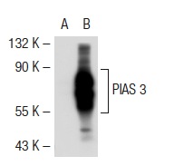 PIAS 3 (C-12): sc-46682. Western blot analysis of PIAS 3 expression in non-transfected: sc-117752 (A) and mouse PIAS 3 transfected: sc-122562 (B) 293T whole cell lysates.