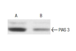 PIAS 3 (C-12): sc-46682. Western blot analysis of PIAS 3 expression in non-transfected control (A) and PIAS 3 siRNA transfected (B) HeLa cell lysates. Kindly provided by The Dr. Michael Rosenfeld Laboratory, University of California San Diego.