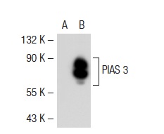 PIAS 3 (E-3): sc-48339. Western blot analysis of PIAS 3 expression in non-transfected: sc-117752 (A) and mouse PIAS 3 transfected: sc-122562 (B) 293T whole cell lysates.