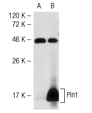 Pin1 (H-123): sc-15340. Western blot analysis of Pin1 expression in non-transfected: sc-117752 (A) and mouse Pin1 transfected: sc-122584 (B) 293T whole cell lysates.