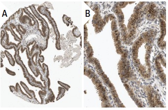 Pin1 (H-123): sc-15340. Immunoperoxidase staining of formalin fixed, paraffin-embedded human fallopian tube tissue showing nuclear and cytoplasmic staining of glandular cells (low and high magnification). Kindly provided by The Swedish Human Protein Atlas (HPA) program.