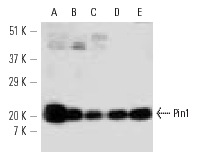 Pin1 (G-8): sc-46660. Western blot analysis of Pin1 expression in Jurkat nuclear extract (A) and PC-3 (B), K-562 (C), NIH/3T3 (D) and PC-12 (E) whole cell lysates.