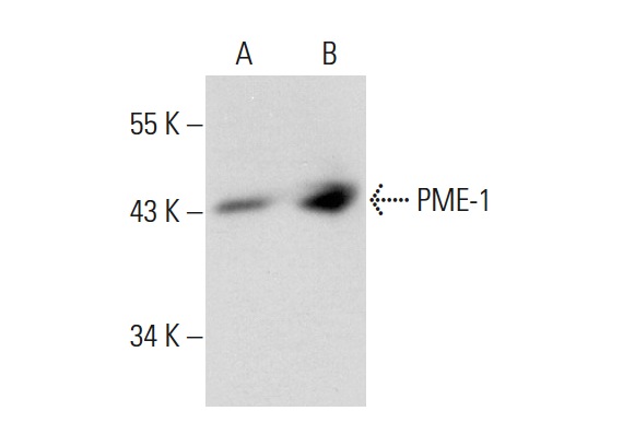 PME-1 (A-10): sc-137145. Western blot analysis of PME-1 expression in non-transfected: sc-117752 (A) and human PME-1 transfected: sc-176706 (B) 293T whole cell lysates.