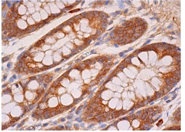 PME-1 (E-8): sc-55472. Immunoperoxidase staining of formalin fixed, paraffin-embedded human rectum tissue showing cytoplasmic staining of glandular cells.