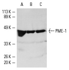 PME-1 (B-12): sc-25278. Western blot analysis of PME-1 expression in K-562 (A), NIH/3T3 (B) and KNRK (C) whole cell lysates.