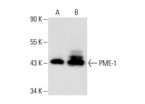 PME-1 (H-226): sc-20086. Western blot analysis of PME-1 expression in non-transfected: sc-117752 (A) and human PME-1 transfected: sc-176706 (B) 293T whole cell lysates.