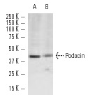 Podocin (H-130): sc-21009. Western blot analysis of Podocin expression in Caki-1 whole cell lysate (A) and mouse kidney tissue extract (B).
