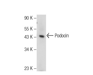 Podocin (H-130): sc-21009. Western blot analysis of Podocin expression in TE671 whole cell lysate.