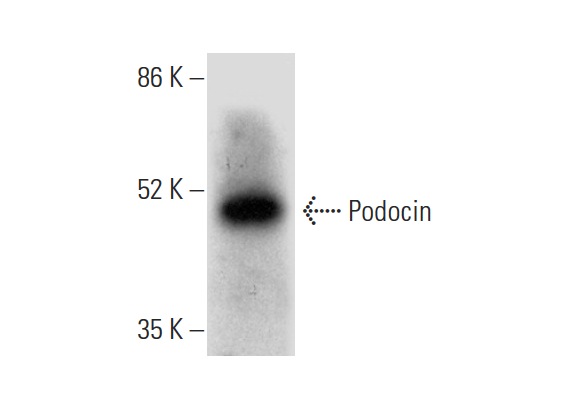Podocin (H-130): sc-21009. Western blot analysis of Podocin expression in Caki-1 whole cell lysate.