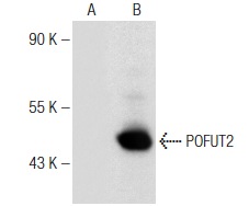 POFUT2 (G-1): sc-271239. Western blot analysis of POFUT2 expression in non-transfected: sc-117752 (A) and mouse POFUT2 transfected: sc-122676 (B) 293T whole cell lysates.