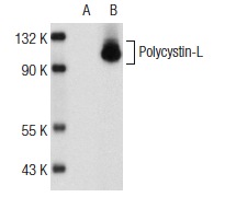 Polycystin-L (D-13): sc-160678. Western blot analysis of Polycystin-L expression in non-transfected: sc-117752 (A) and human Polycystin-L transfected: sc-159498 (B) 293T whole cell lysates.