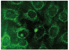 AdipoR1 (C-14): sc-46748. Immunofluorescence staining of methanol-fixed HeLa cells showing cytoplasmic localization.