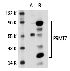 PRMT7 (K-18): sc-48658. Western blot analysis of PRMT7 expression in non-transfected: sc-110760 (A) and human PRMT7 transfected: sc-110644 (B) 293 whole cell lysates.