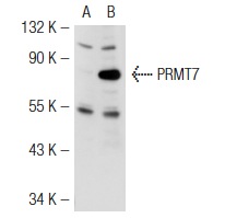 PRMT7 (K-18): sc-48658. Western blot analysis of PRMT7 expression in non-transfected: sc-117752 (A) and mouse PRMT7 transfected: sc-122782 (B) 293T whole cell lysates.