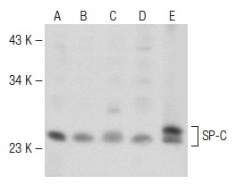 SP-C (FL-197): sc-13979. Western blot analysis of SP-C expression in Mv 1 Lu (A), AMJ2-C8 (B), AMJ2-C11 (C), MH-S (D) and P 23 (E) whole cell lysates.