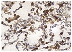 SP-C (FL-197): sc-13979. Immunoperoxidase staining of formalin fixed, paraffin-embedded human lung tissue showing cytoplasmic staining of pneumocytes and macrophages.