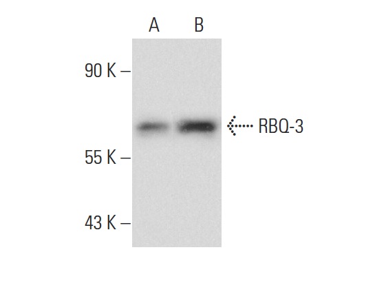 RBQ-3 (H-269): sc-98551. Western blot analysis of RBQ-3 expression in non-transfected: sc-117752 (A) and human RBQ-3 transfected: sc-176325 (B) 293T whole cell lysates.