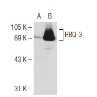 RBQ-3 (H-269): sc-98551. Western blot analysis of RBQ-3 expression in non-transfected: sc-117752 (A) and human RBQ-3 transfected: sc-116474 (B) 293T whole cell lysates.