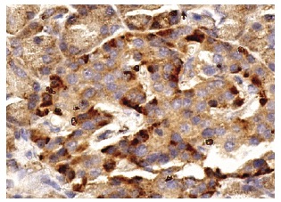 REDD-1 (H-110): sc-67051. Immunoperoxidase staining of formalin fixed, paraffin-embedded human pancreas tissue showing cytoplasmic staining of Islets of Langerhans and glandular cells.