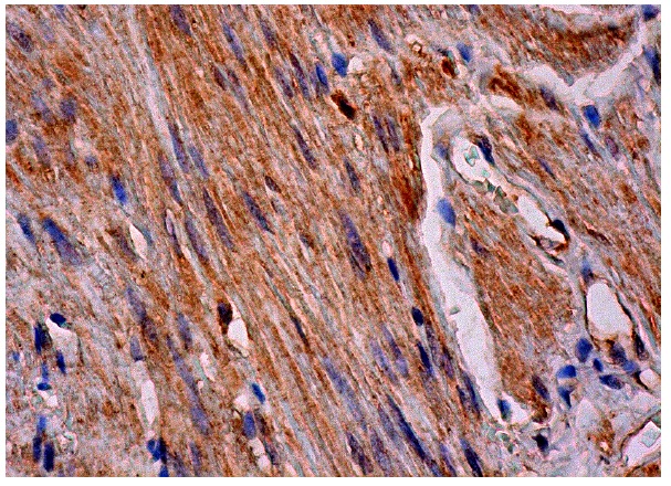 REDD-1 (H-110): sc-67051. Immunoperoxidase staining of formalin fixed, paraffin-embedded human smooth muscle tissue showing cytoplasmic staining of smooth muscle cells.
