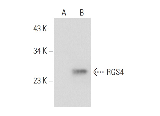 RGS4 (C-17): sc-6203. Western blot analysis of RGS4 expression in non-transfected: sc-117752 (A) and human RGS4 transfected: sc-116320 (B) 293T whole cell lysates.