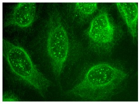 RGS4 (C-17): sc-6203. Immunofluorescence staining of methanol-fixed HeLa cells showing nuclear, cytoplasmic and membrane localization.
