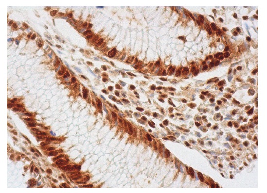 RGS4 (C-17): sc-6203. Immunoperoxidase staining of formalin fixed, paraffin-embedded human appendix tissue showing cytoplasmic and nuclear staining of glandular cells.
