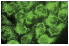 RGS6/7 (H-190): sc-28836. Immunofluorescence staining of methanol-fixed HeLa cells showing cytoplasmic localization.