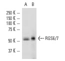 RGS6/7 (H-190): sc-28836. Western blot analysis of RGS6 and RGS7 expression in TT whole cell lysate (A) and mouse cerebellum tissue extract (B).