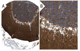 RGS6/7 (H-190): sc-28836. Immunoperoxidase staining of formalin fixed, paraffin-embedded human cerebellum tissue showing cytoplasmic staining of cells in molecular and granular layers and Purkinje cells at low (A) and high (B) magnification. Kindly provided by The Swedish Human Protein Atlas (HPA) program.