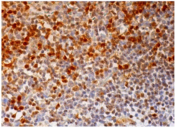 RGS10 (A-8): sc-46679. Immunoperoxidase staining of formalin fixed, paraffin-embedded human tonsil tissue showing nuclear staining of cells in germinal center and nuclear and cytoplasmic staining of cells in non-germinal center.
