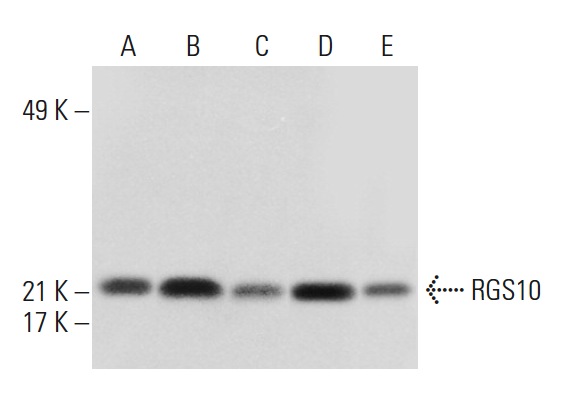 RGS10 (C-20): sc-6206. Western blot analysis of RGS10 expression in BJAB (A), CCRF-CEM (B), Ramos (C), Jurkat (D) and Y79 (E) whole cell lysates.