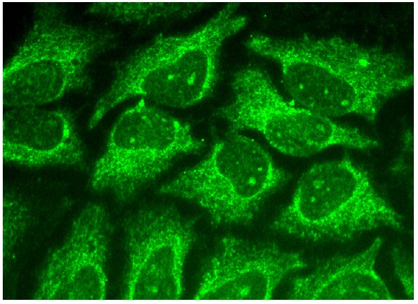 Ribosomal Protein L3 (C-14): sc-86826. Immuno-fluorescence staining of methanol-fixed HeLa cells showing cytoplasmic and nucleolar localization.