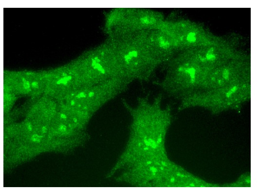 Ribosomal Protein L3 (C-14): sc-86826. Immunofluorescence staining of formalin-fixed HepG2 cells showing nucleolar, nuclear and cytoplasmic localization.