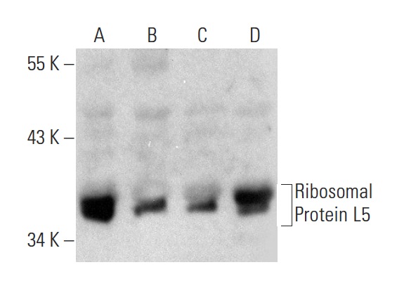 Ribosomal Protein L5 (D-20): sc-103865. Western blot analysis of Ribosomal Protein L5 expression in HeLa (A), COLO 320DM (B), PC-3 (C) and Caki-1 (D) whole cell lysates.