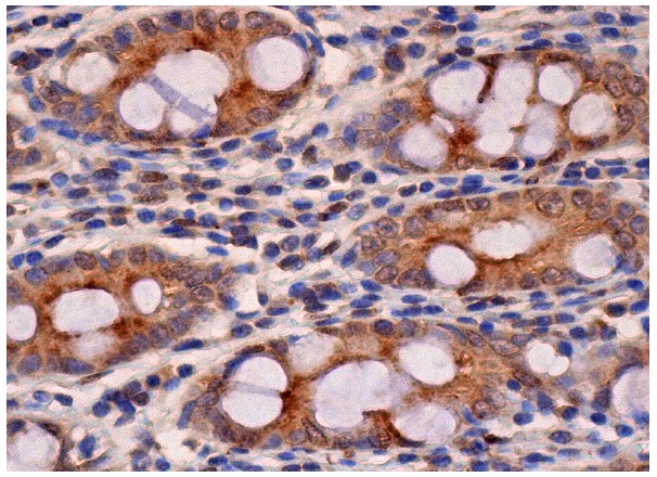 Ribosomal Protein L5 (D-20): sc-103865. Immunoperoxidase staining of formalin fixed, paraffin-embedded human rectum tissue showing cytoplasmic staining of glandular cells.