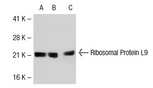 Ribosomal Protein L9 (T-17): sc-102085. Western blot analysis of Ribosomal Protein L9 expression in non-transfected 293T: sc-117752 (A), human Ribosomal Protein L9 transfected 293T: sc-111716 (B) and HeLa (C) whole cell lysates.