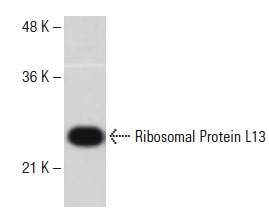 Ribosomal Protein L13 (U-25): sc-133960. Western blot analysis of Ribosomal Protein L13 expression in Jurkat whole cell lysate.