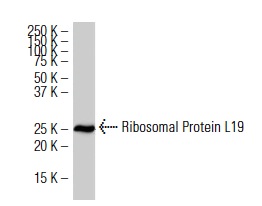 Ribosomal Protein L19 (K-12): sc-100830. Western blot analysis of Ribosomal Protein L19 expression in HeLa whole cell lysate.