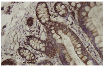 Ribosomal Protein L19 (K-12): sc-100830. Immunoperoxidase staining of formalin-fixed, paraffin-embedded human small Intestine tissue showing cytoplasmic localization.