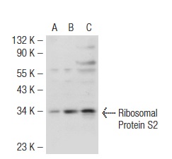Ribosomal Protein S2 (80-H): sc-130399. Western blot analysis of Ribosomal Protein S2 expression in non-transfected 293T: sc-117752 (A), human Ribosomal Protein S2 transfected 293T: sc-114060 (B) and K-562 (C) whole cell lysates.