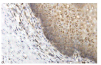Ribosomal Protein S2 (80-H): sc-130399. Immunoperoxidase staining of formalin-fixed, paraffin-embedded human esophagus tissue showing cytoplasmic localization.