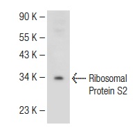 Ribosomal Protein S2 (80-H): sc-130399. Western blot analysis of Ribosomal Protein S2 expression in Jurkat whole cell lysate.