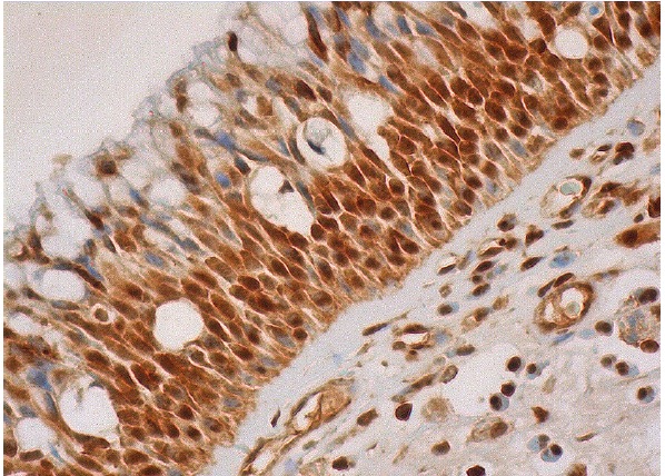 Ribosomal Protein S3 (E-6): sc-376098. Immunoperoxidase staining of formalin fixed, paraffin-embedded human nasopharynx tissue showing nuclear and cytoplasmic staining of respiratory epithelial cells and inflammatory cells.