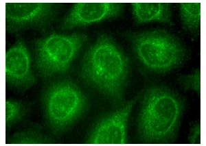 ALR (V-16): sc-51257. Immunofluorescence staining of methanol-fixed HeLa cells showing cytoplasmic localization.