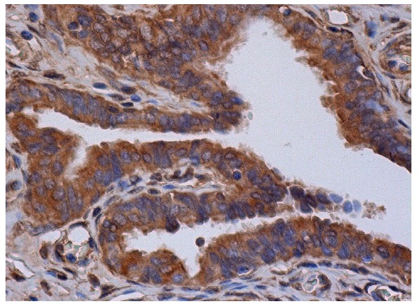 ALR (V-16): sc-51257. Immunoperoxidase staining of formalin fixed, paraffin-embedded human fallopian tube tissue showing cytoplasmic staining of glandular cells.