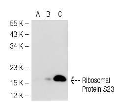 Ribosomal Protein S23 (SJ-K2): sc-100837. Western blot analysis of Ribosomal Protein S23 expression in non-transfected 293T: sc-117752 (A), mouse Ribosomal Protein S23 transfected 293T: sc-123184 (B) and HeLa (C) whole cell lysates.
