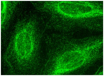 RNH1 (C-14): sc-49697. Immunofluorescence staining of formalin-fixed HeLa cells showing cytoplasmic localization.